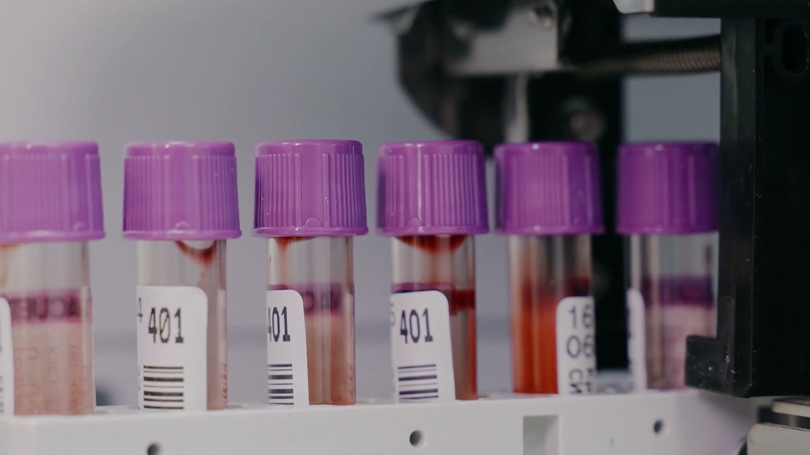 Tubes of salmon-coloured culture medium in a rack at the institute's certified cell laboratory